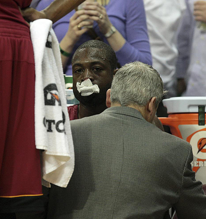 El jugador de los Heat fue protagonista poco después tras recibir un golpe de Aaron Brooks. En la imagen, Wade intenta olvidarse del dolor y prestar atención a las indicaciones del técnico Jay Sabol.