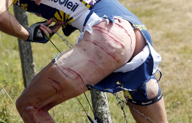 Hoogerland tuvo cortes profundos en su pierna como consecuencia de las vallas con alambres.