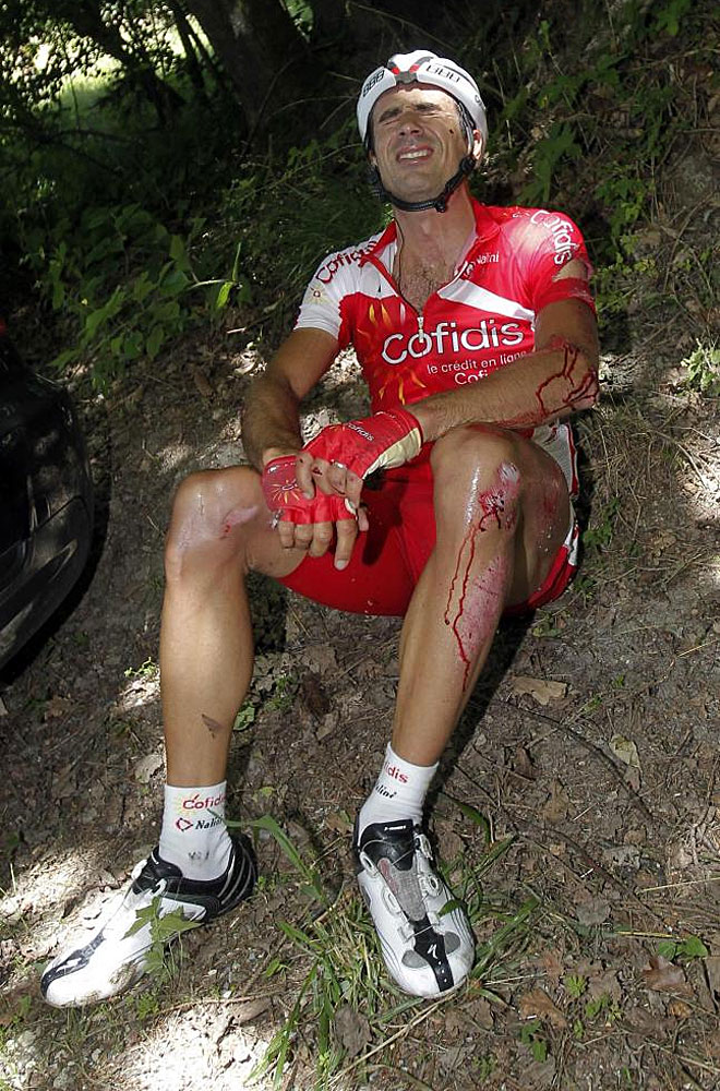 El corredor del Cofidis muestra sus 'heridas de guerra' tras la cada que le ha obligado a abandonar la carrera.