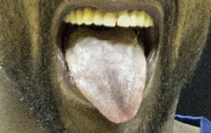 Primer plano de la lengua de Tony Allen (Grizzlies)