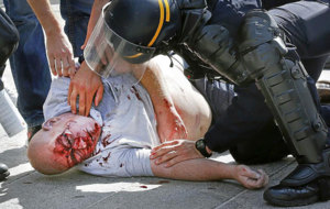 Un aficionado ingls agredido en los enfrentamientos de Marsella.