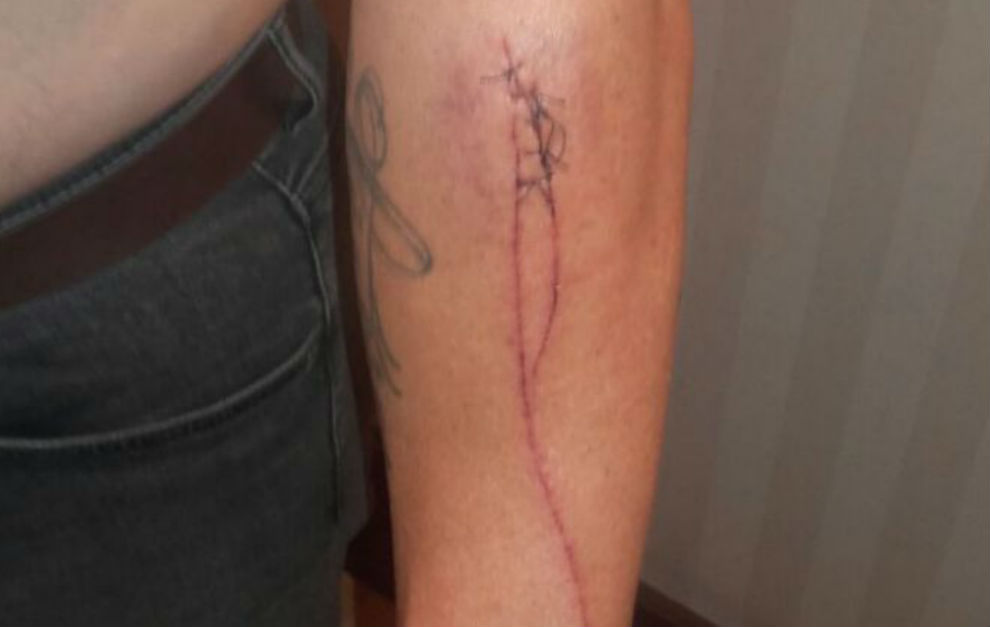 Imagen de una de las heridas que denuncia Jos Guerrero
