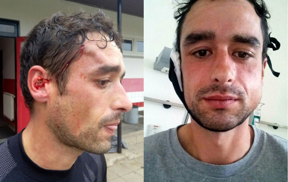 Montaje de las dos heridas que ha sufrido el jugador Alberto Mier...