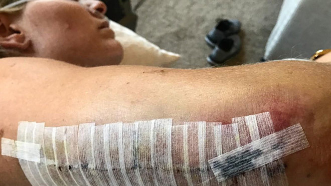 Lindsey Vonn ha colgado esta foto de su cicatriz en su perfil de...