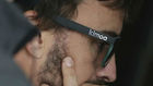Alonso y las gafas de sol de Kimoa, antesala de su nueva marca de...