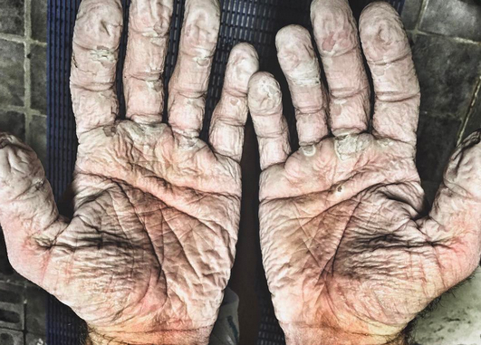Las manos del doble oro olmpico Alex Gregory durante una expedicin...