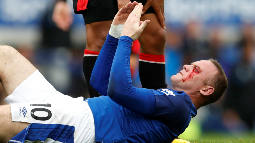Rooney se lamenta en el suelo con el ojo ensangrentado.