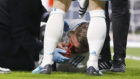 Sergio Ramos sufre una fractura en la nariz.