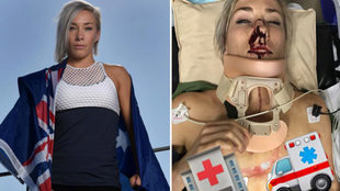 Caroline Buchanan (27 aos) sufri un grave accidente (derecha).