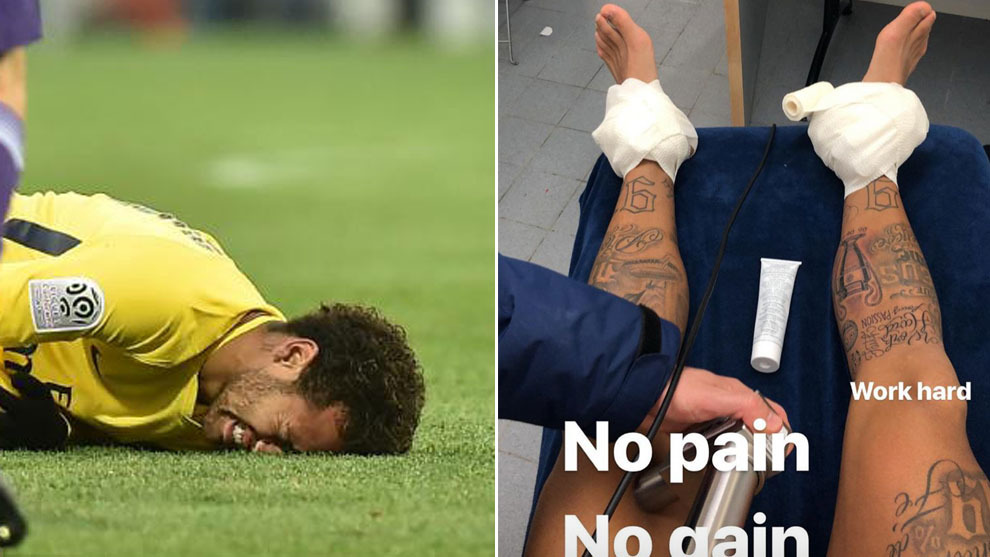 Neymar se duele a la izquierda; a la derecha, sus tobillos vendados
