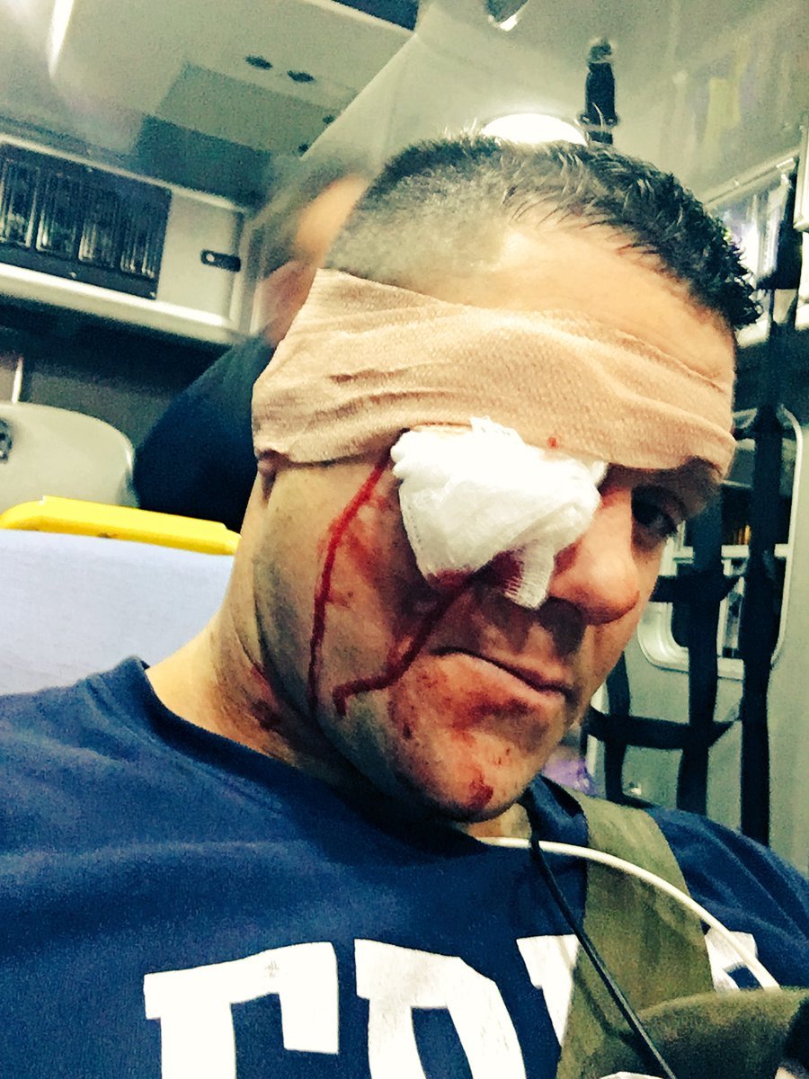 Eddie Edwards tras recibir el golpe en la cara con un bate de bisbol...
