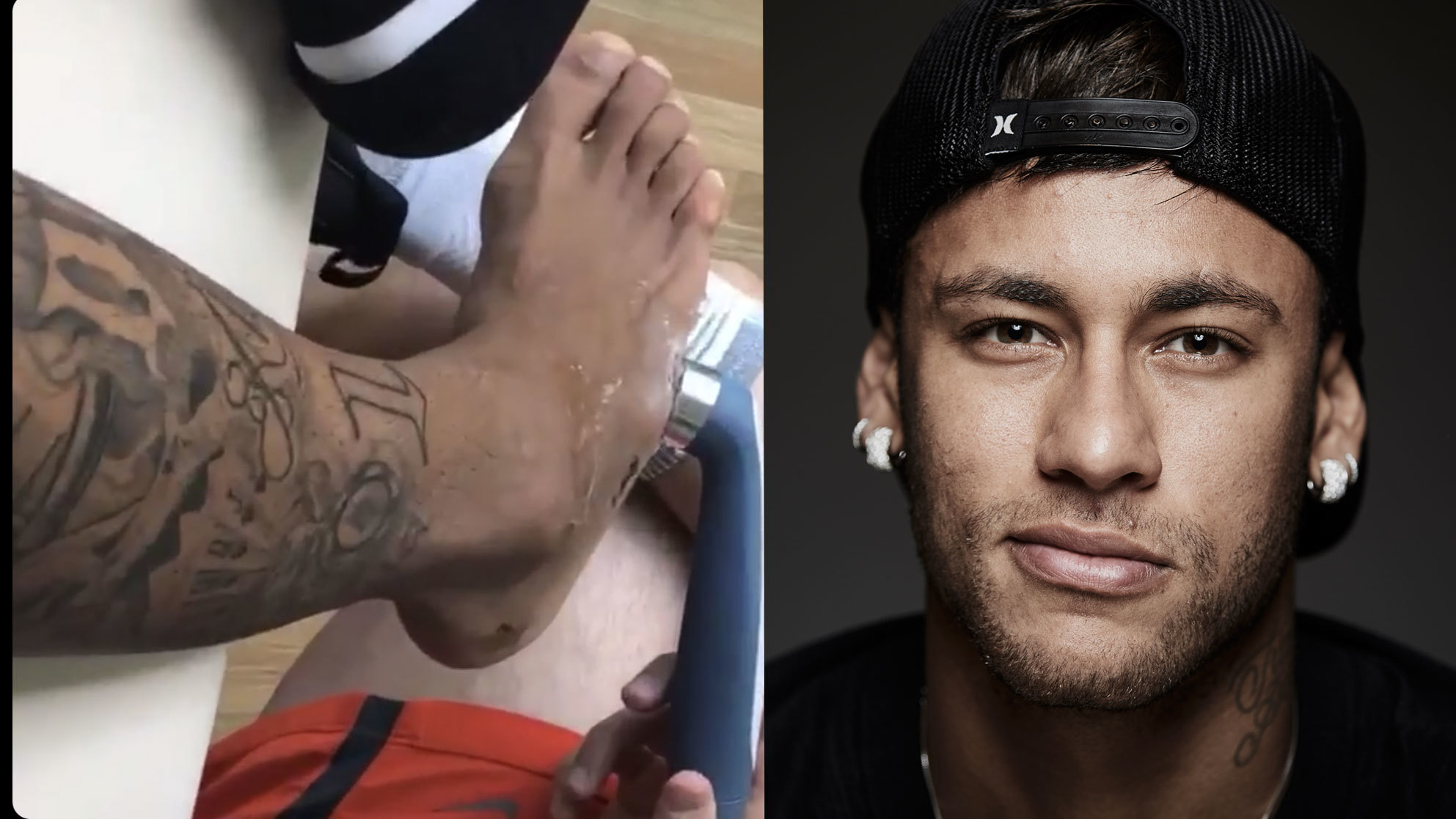 Pie de Neymar Jr. recibiendo ultrasonidos en e tobillo