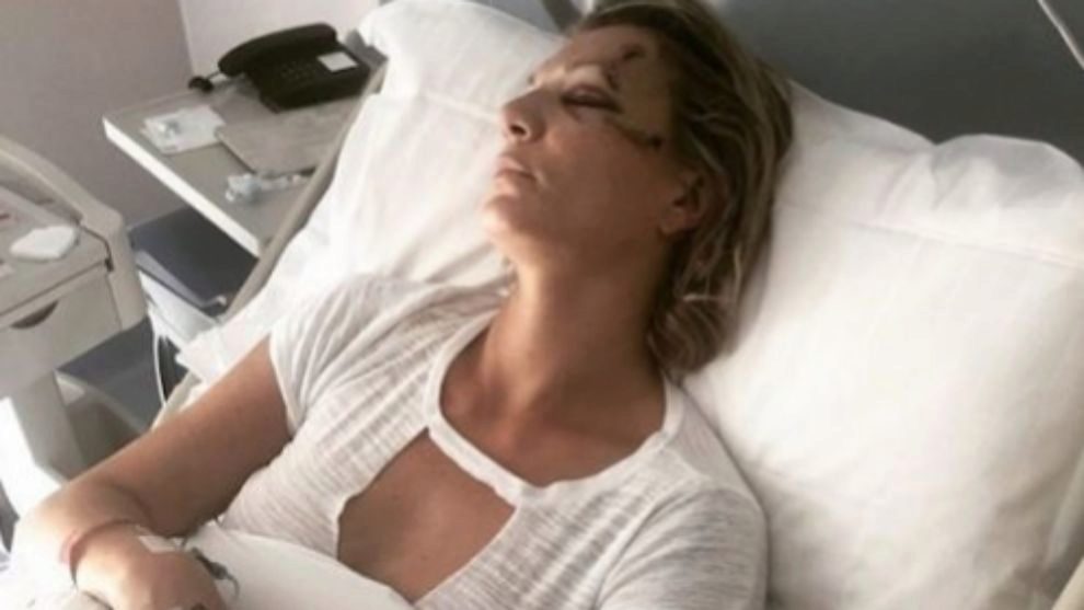 Maria Hoefl Riesch, en el hospital de Brescia donde fue operada del...