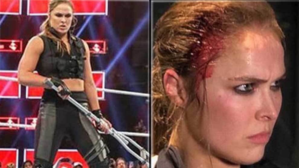 In principle, Becky Lynch could not fight Ronda Rousey due to a knee...