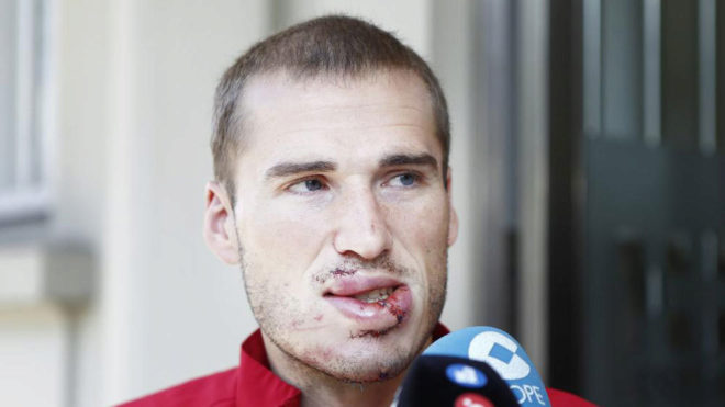 Alex Bergantinos leaving hospital after the operation.