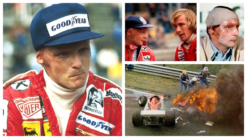 Las confesiones de Niki Lauda: "Algunos hombres son feos de nacimiento, yo al menos tengo una excusa"