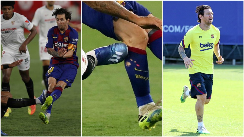 La entrada de Diego Carlos y cómo quedó la pierna de Messi.