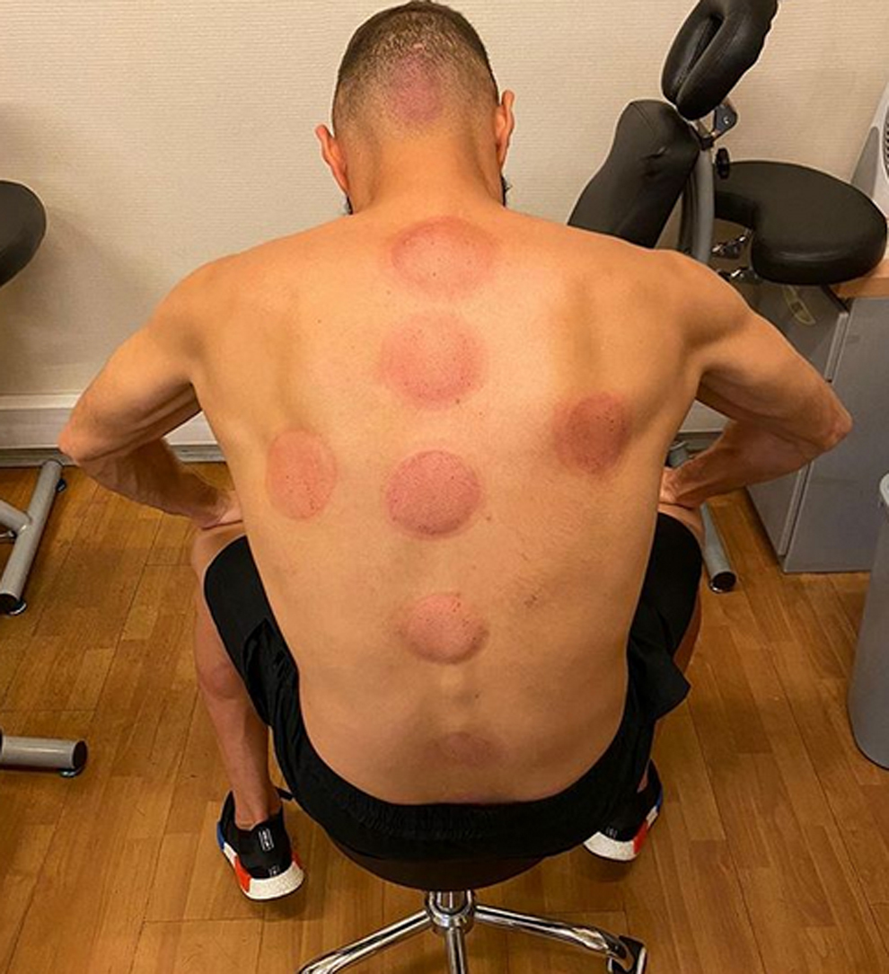 Benzema muestra el estado de su espalda tras una sesin de...