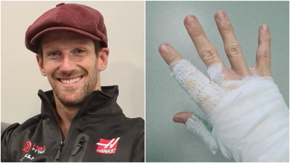 Grosjean muestra su lastimada mano derecha.