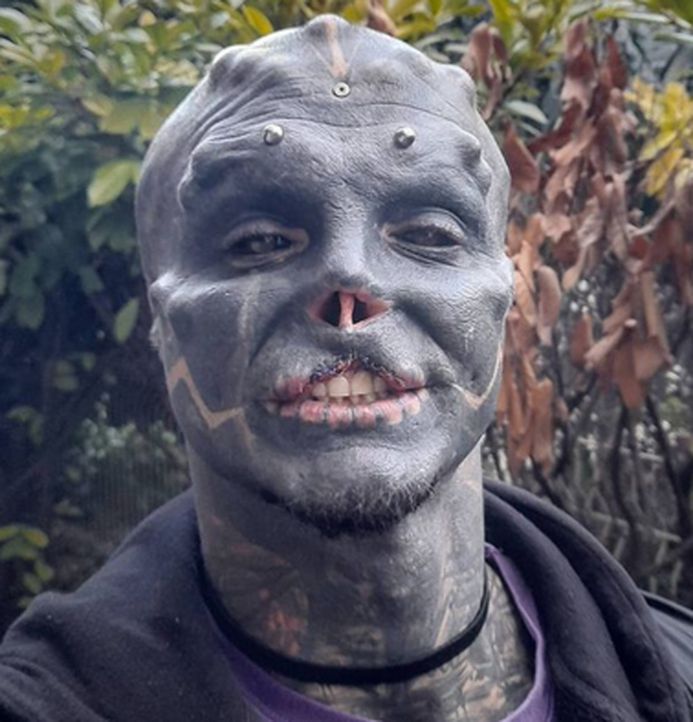 Black Alien Se Corta La Pierna