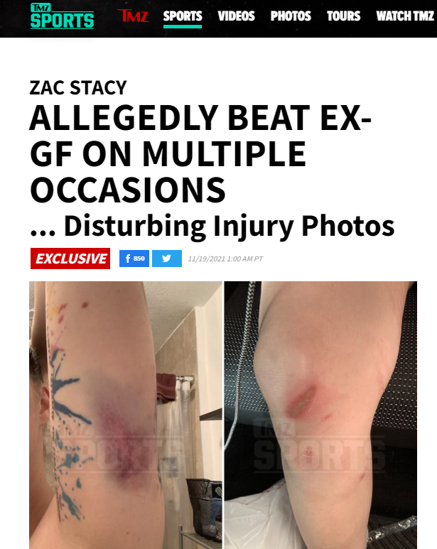 Photos of previous beatings, published by TMZ.