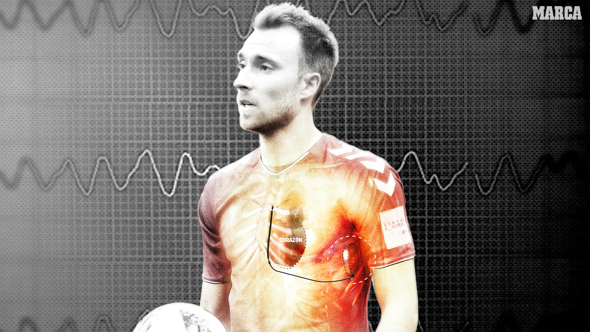 ICD: The defibrillator that means Eriksen can play again