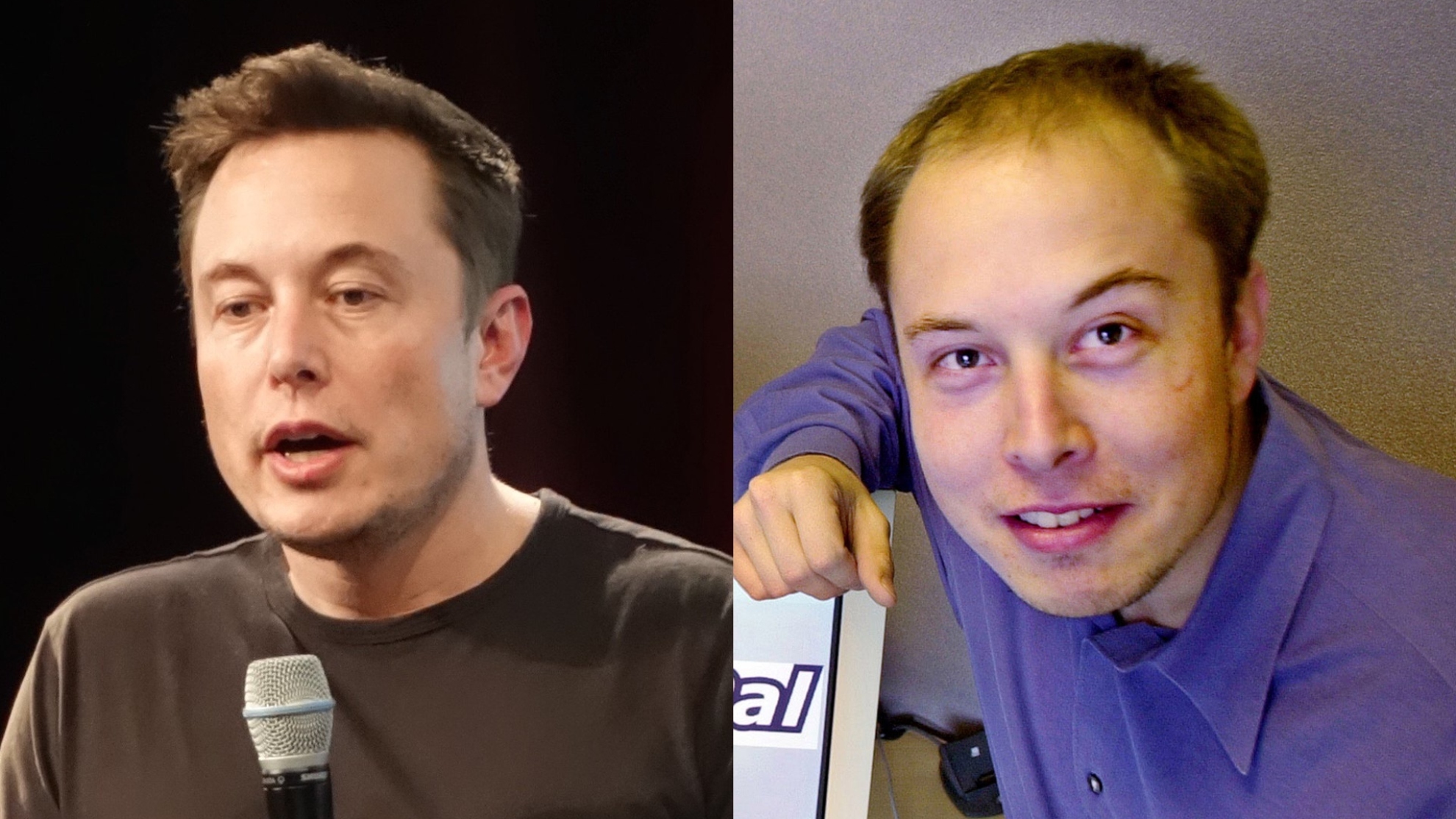 Elon Musk: Did the mogul undergo a hair transplant treatment? | Marca