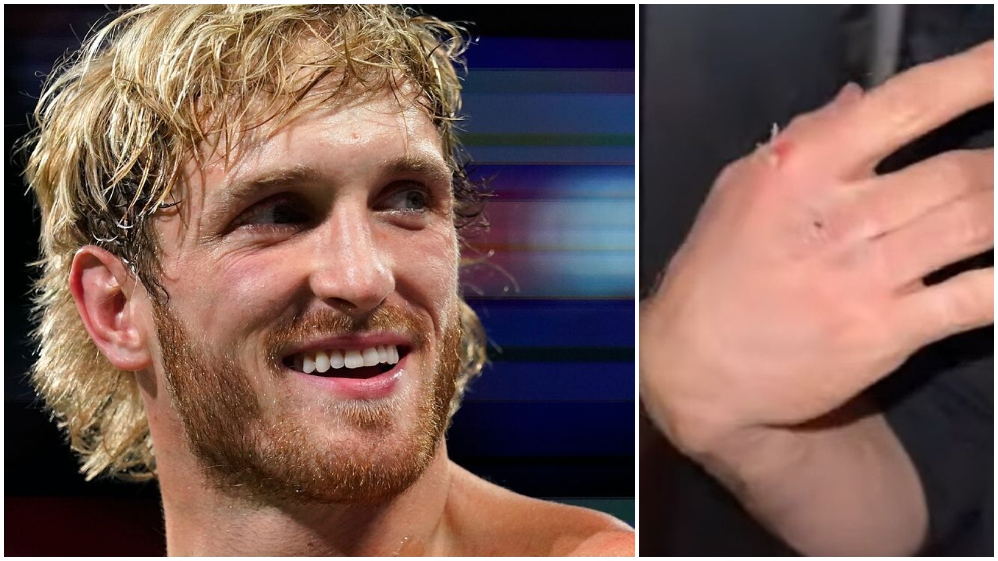 Logan Paul shares footage of the punch that broke his hand