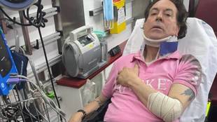 Pipi Estrada sufre un accidente de moto en Madrid