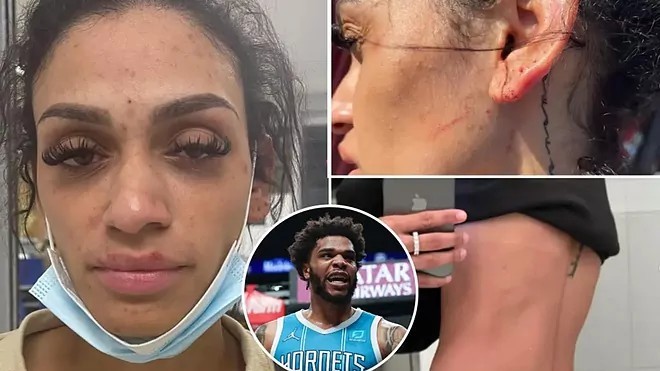 La esposa de Bridges colgó estas fotos de las heridas sufridas en redes sociales.