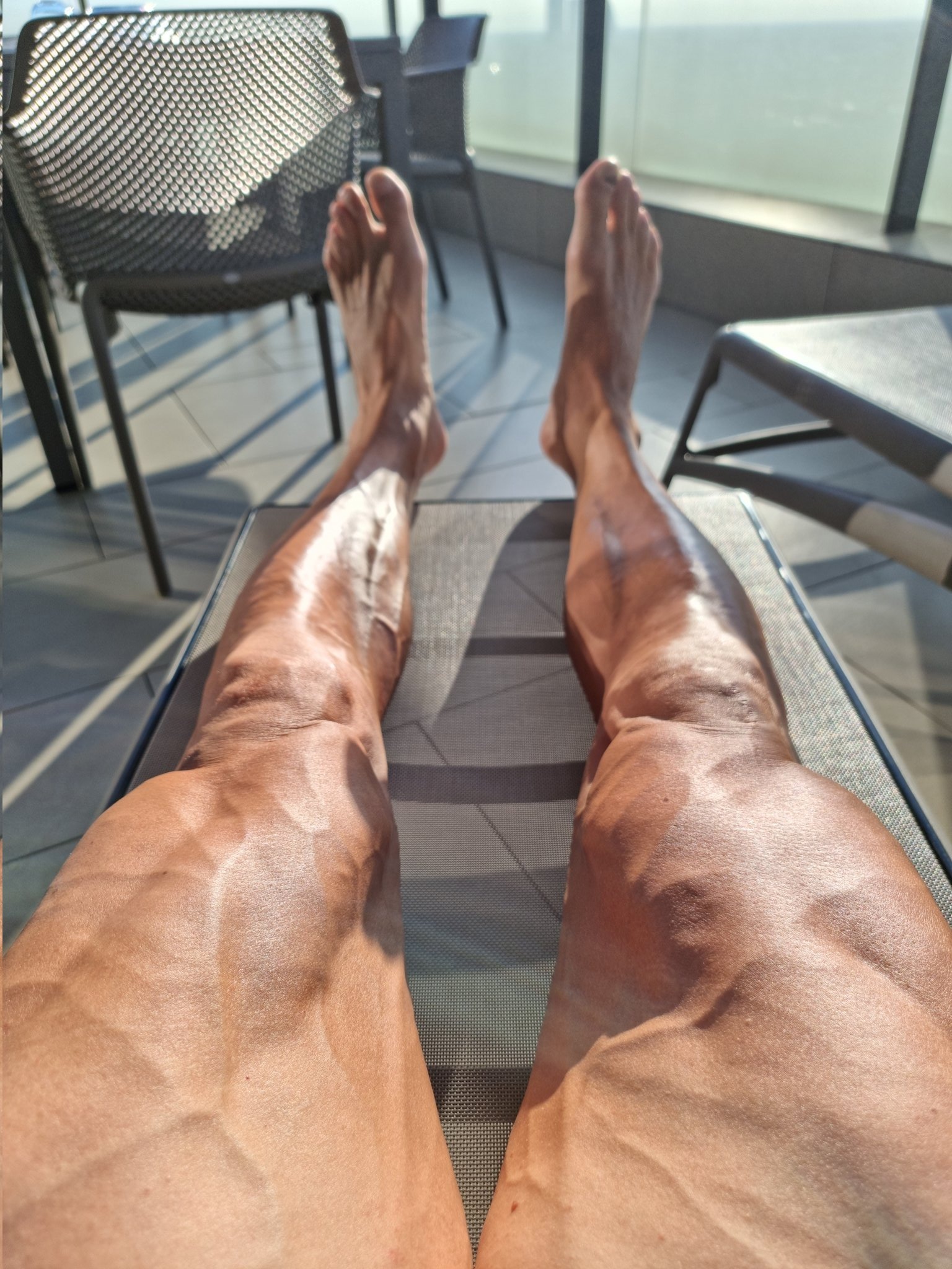 Serie A: La impactante imagen de las piernas de Ibrahimovic tras su operación: ¿Eres humano?