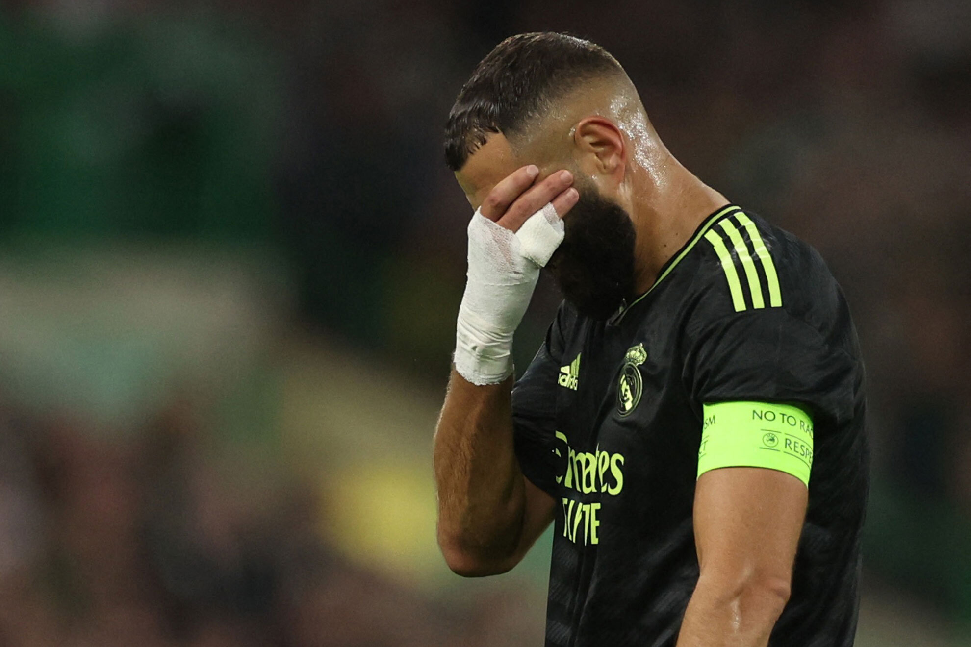 ¿Qué le pasó a Benzema? El francés no terminó el partido ante el Celtic | Reuters
