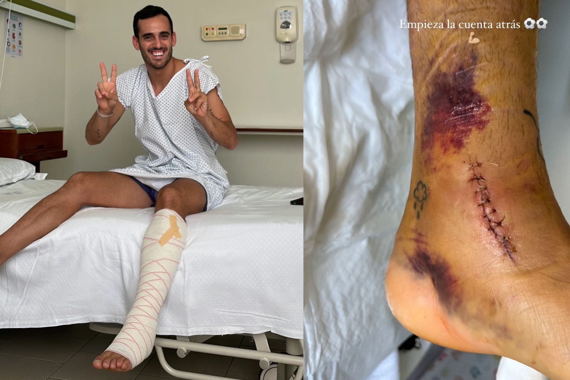 Juanmi, en el hospital, muestra la cicatriz de su cirugía de tobillo | INSTAGRAM