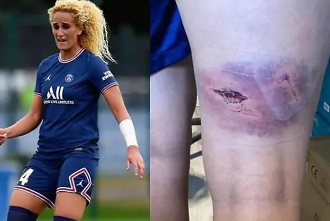 Un montaje con una imagen de Kheira Hamraoui en un partido y otra de su pierna tras el ataque.