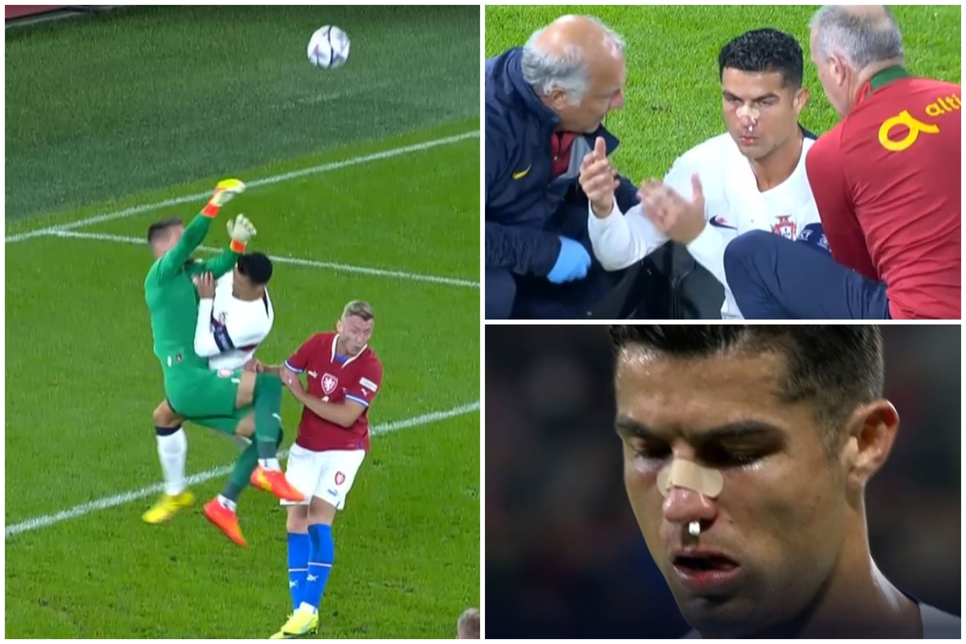 Cristiano Ronaldo recibe un tremendo golpe que lo deja ensangrentado