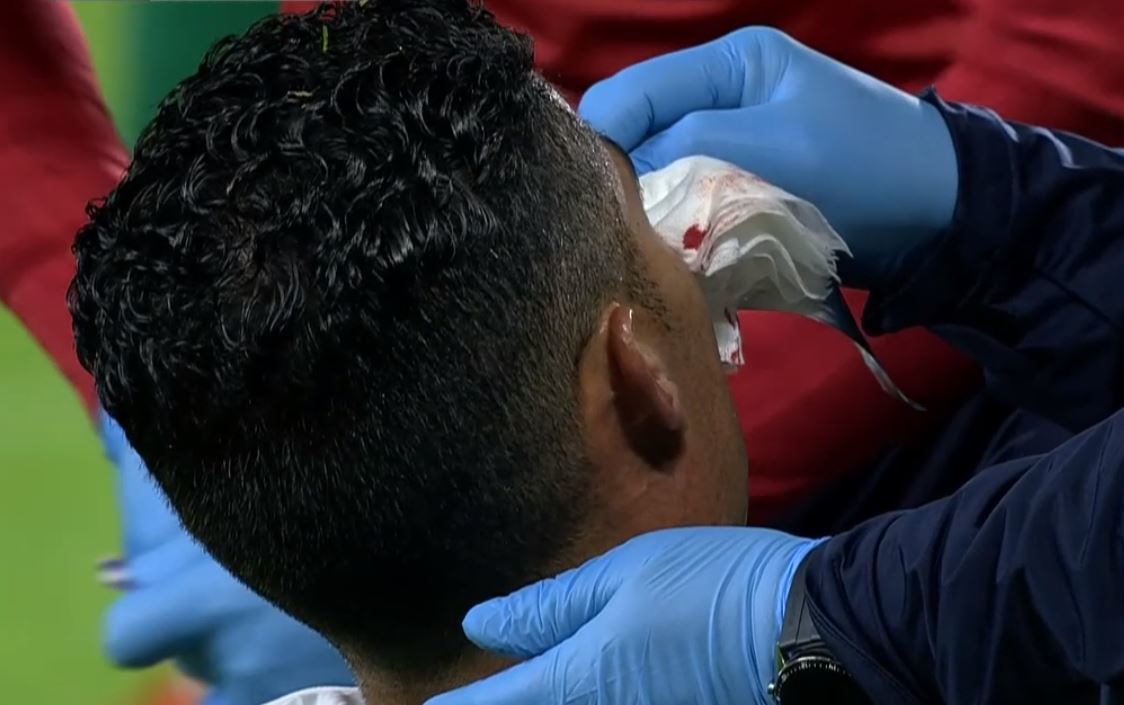 Cristiano Ronaldo se lleva un tremendo golpe en la cara que le deja con la nariz ensangrentada