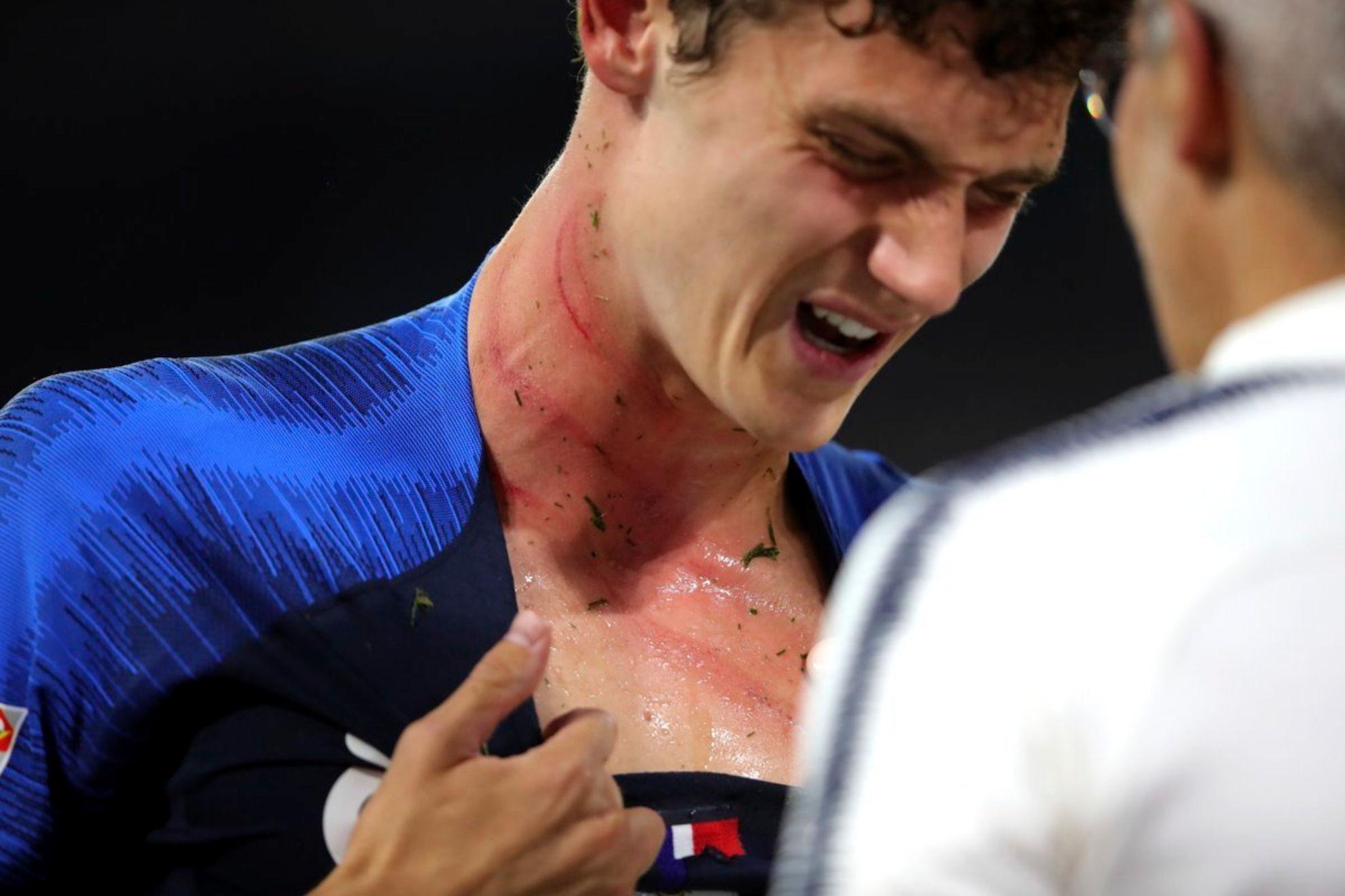 Pavard, atendido por un médico, durante un partido de la selección francesa.
