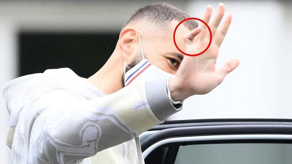 Por qué Benzema lleva siempre un vendaje en la mano y cuánto lleva jugando así