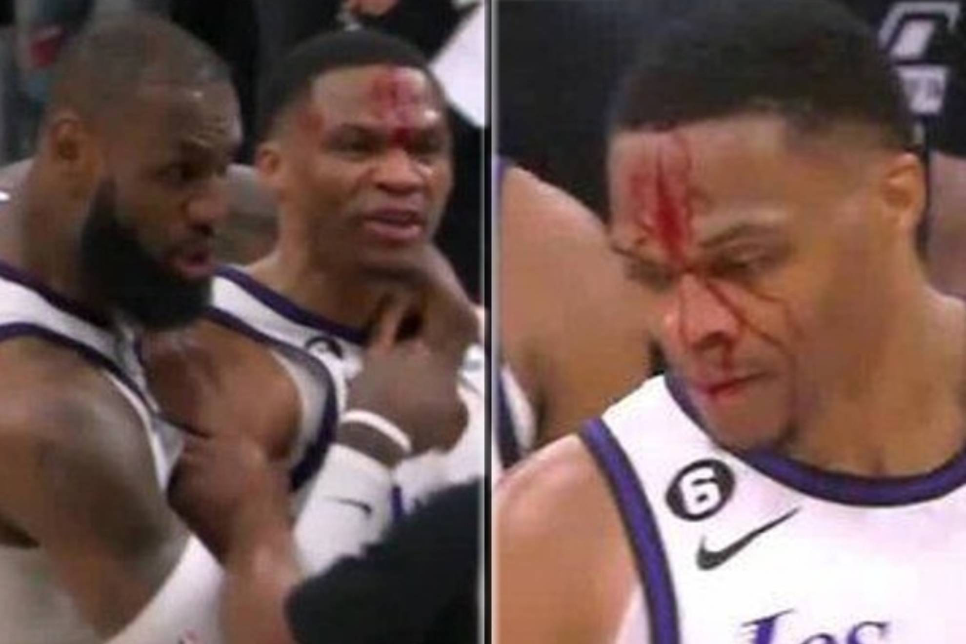 Russell Westbrook bleeds and LeBron James defends him