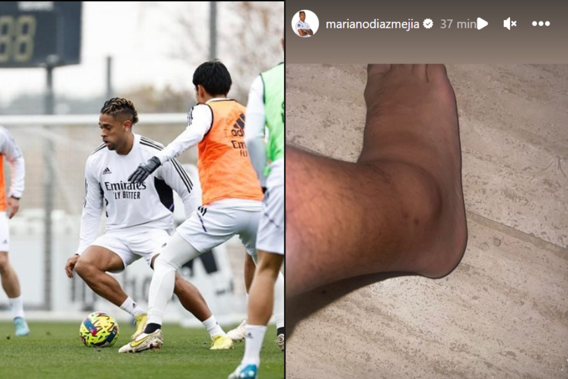Mariano ha subido a su cuenta de Instagram una foto con su tobillo derecho hinchado.