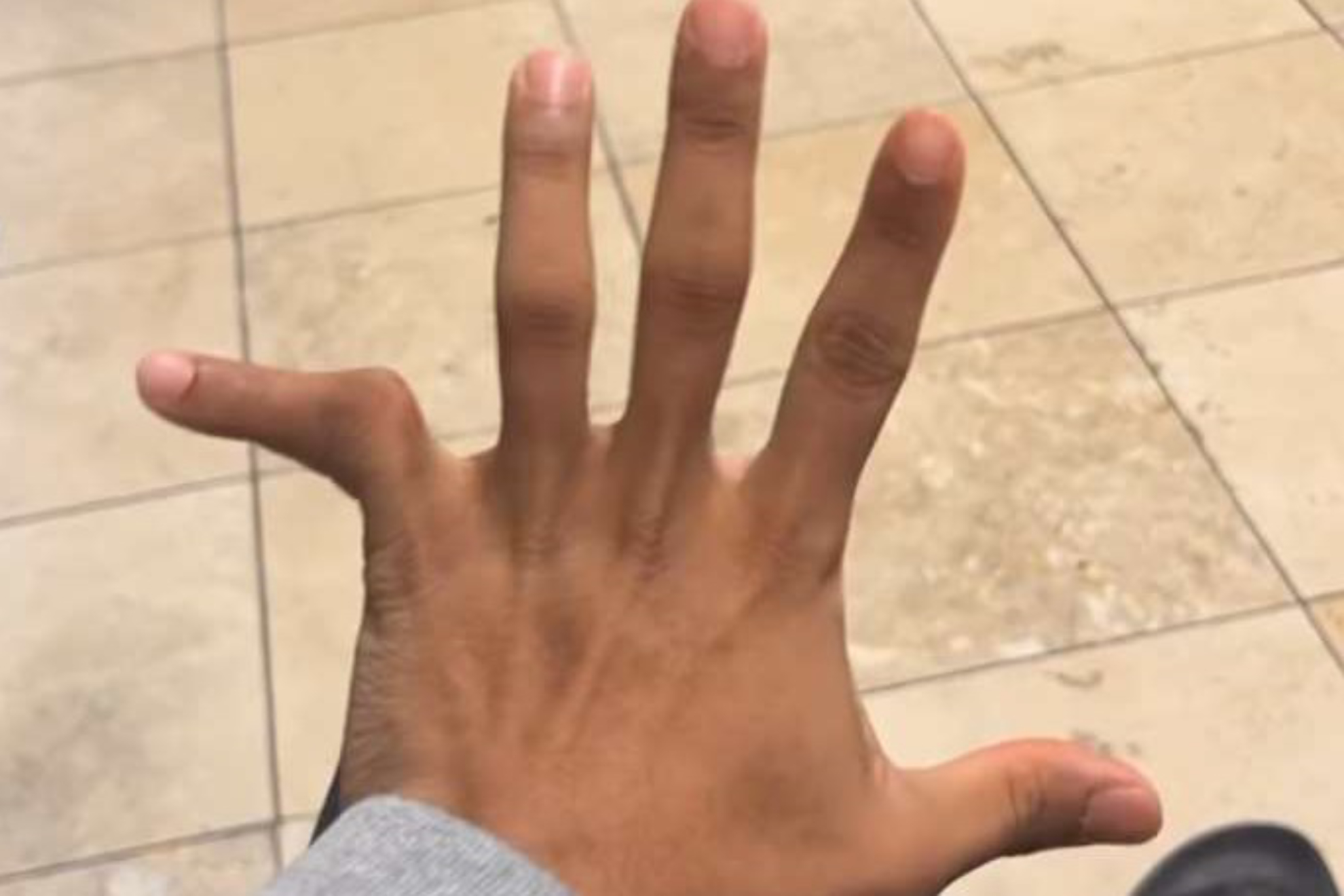 Rondale Moore hand.