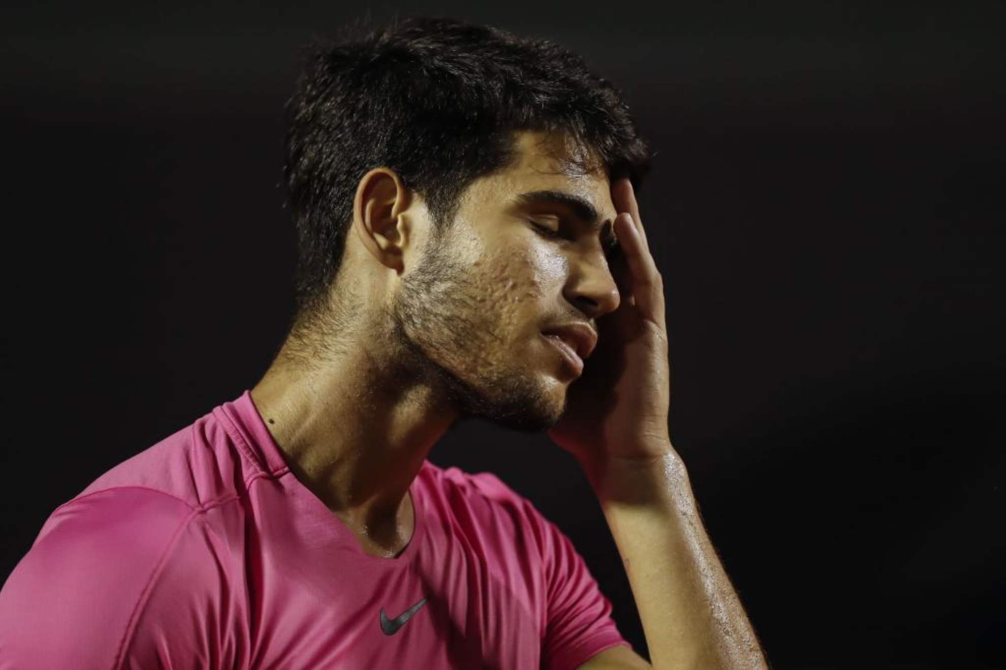 Tennis: Alcaraz has problems again: We have to see how serious the injury  is | Marca