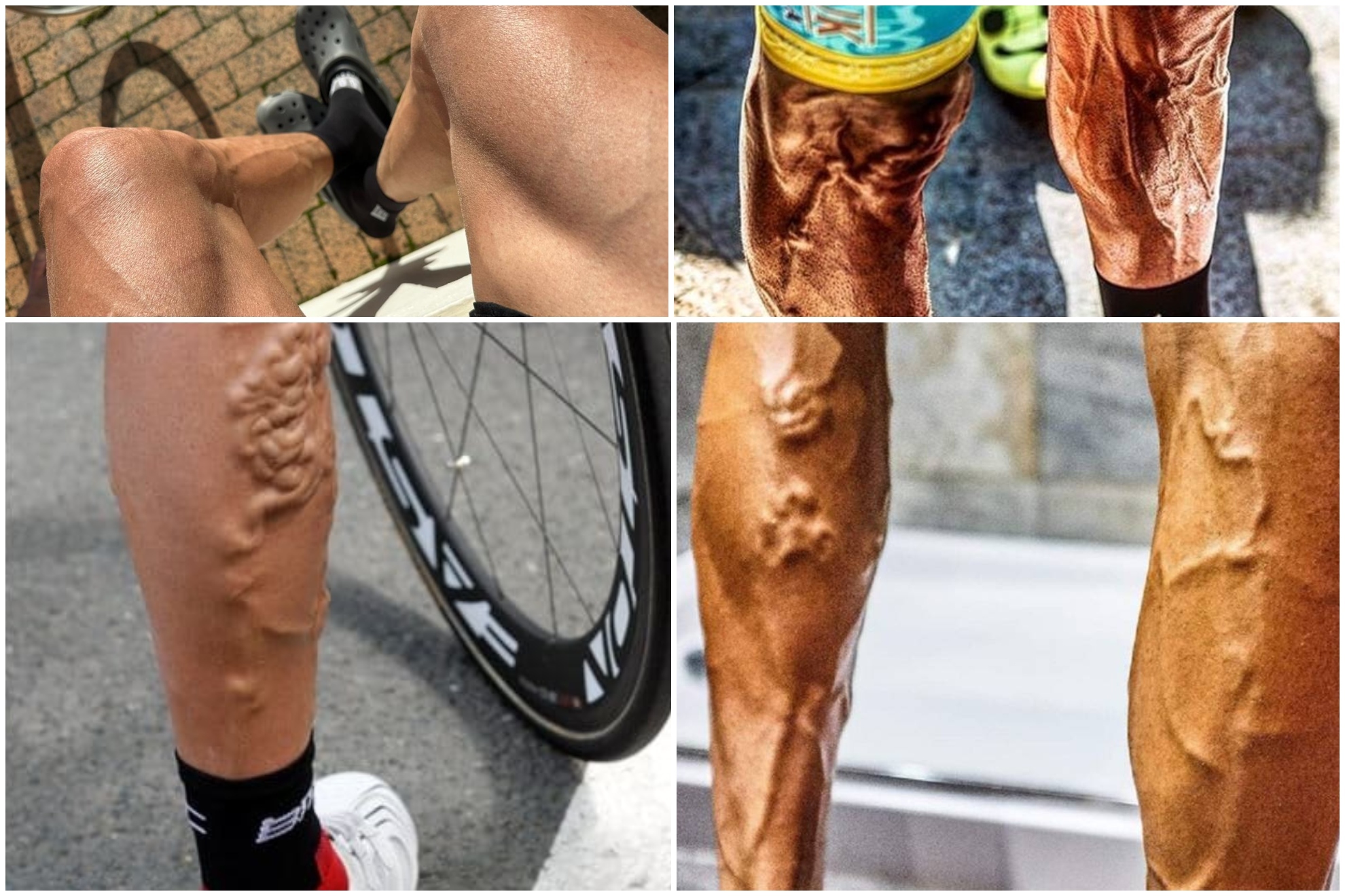 Las piernas 'virales' de Luis Enrique tras la Cape Epic y otras 'patas monstruosas' de ciclistas