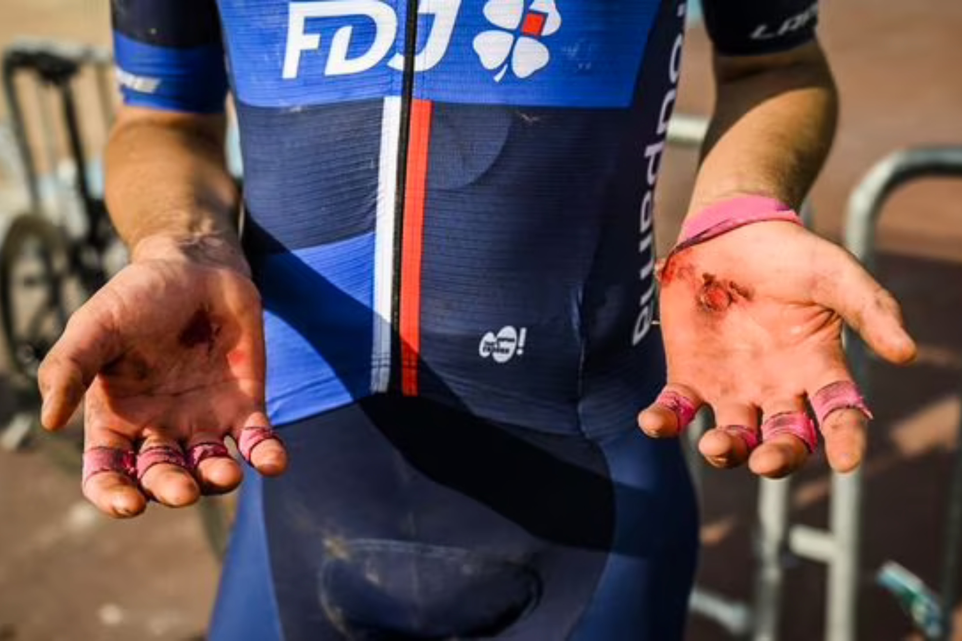 Duele slo con verlas: as se te quedan las manos tras competir en la Roubaix