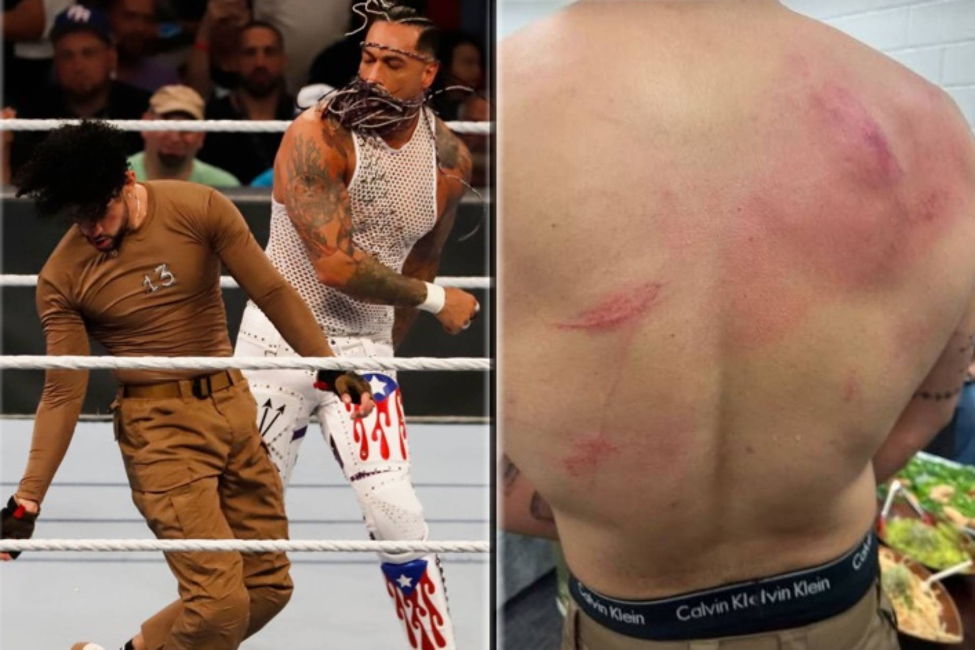 Bad Bunny muestra sus heridas tras ganar a Damian Priest  en una pelea callejera de la WWE