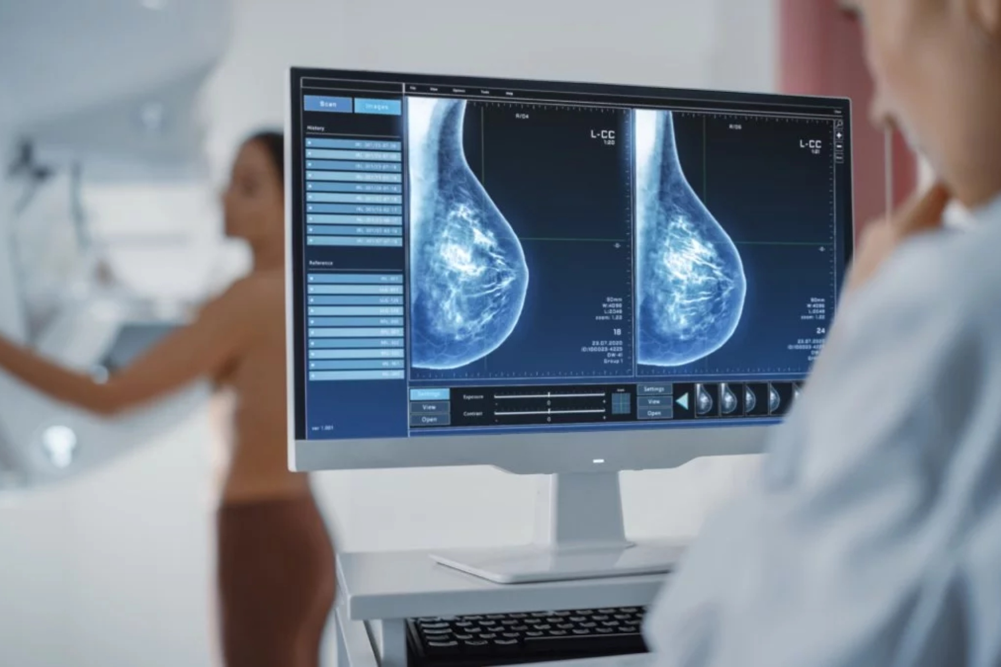 Un estudio demuestra que la Inteligencia Artificial puede ayudar en la deteccin del cncer de mama