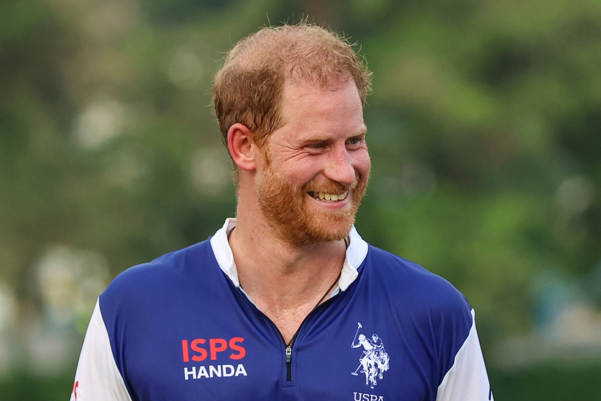 Prince Harry's new hair plugs might just be the crowning moment of his life