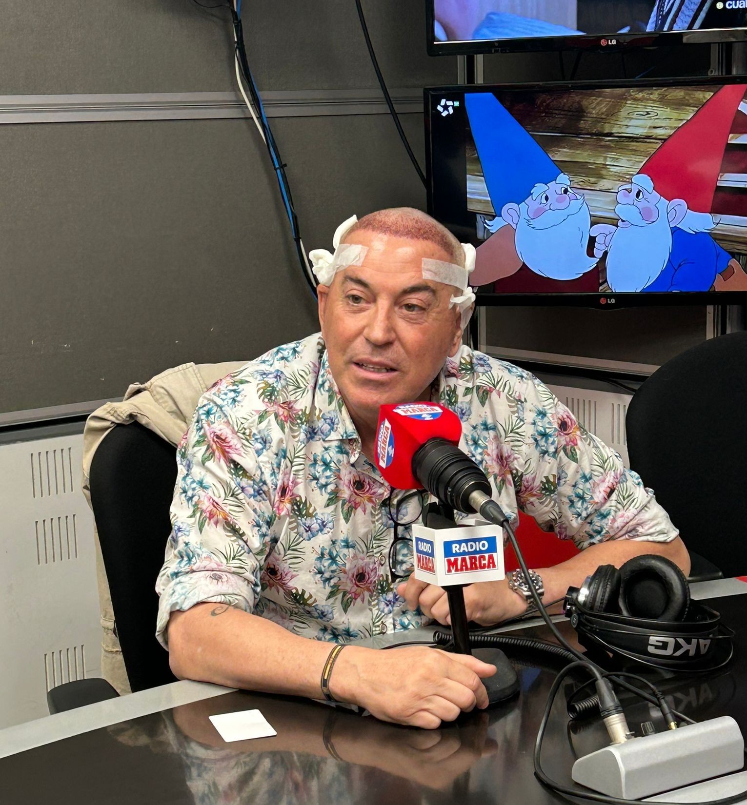 Pipi Estrada presenta su nueva imagen en Radio MARCA: los detalles de su injerto de pelo