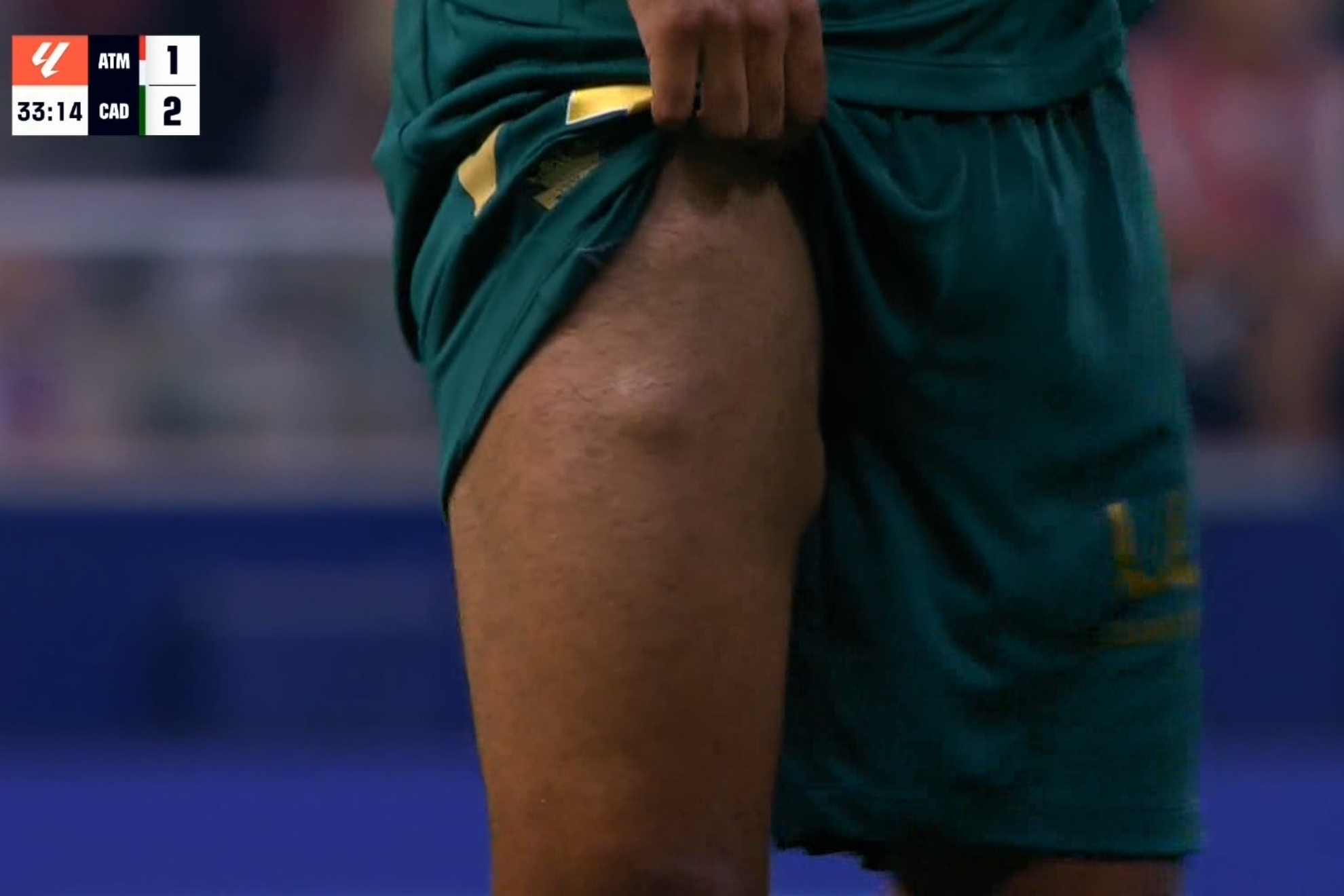 La impactante imagen del muslo de Fali tras pedir el cambio: "No es de hoy, viene de antiguas lesiones"