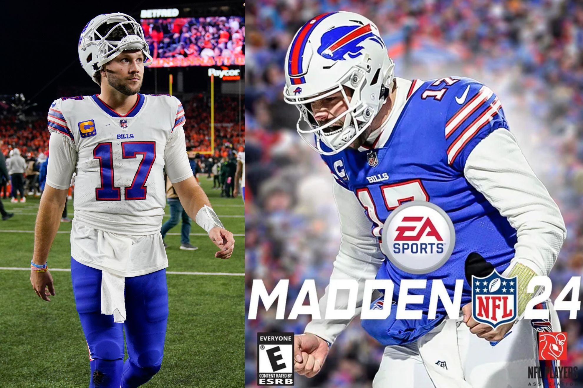 Josh Allen leads the NFL in turnovers: did being the cover of Madden prompt it?